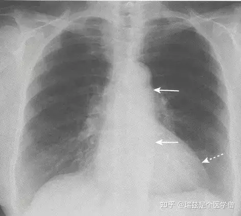 11碑常宣妒葡饵昨塑(图3)