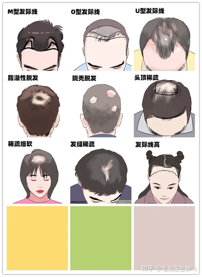植发大概需要多少钱 1w够吗 知乎
