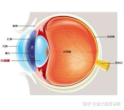 首大张兰 白内障症状早知道 知乎