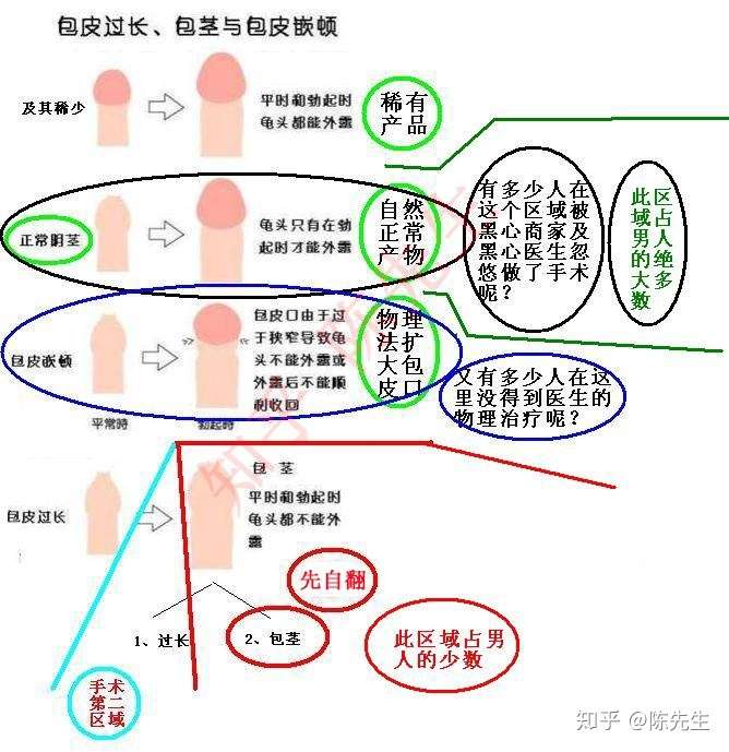 自己了解过和包皮过长有关的信息,自己确认是包皮过长(包茎)并知其