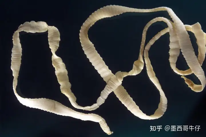 绦虫图片? - 知乎
