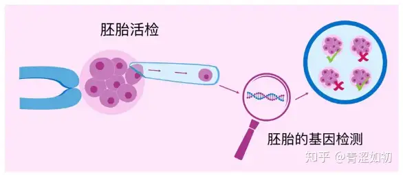 成都正规助孕机构（试管婴儿的利弊分析）