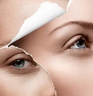 宁波去鱼尾纹手术注意事项岁月的流失终于成为了人们的烦恼