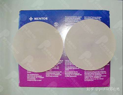 隆胸材料曼托傲诺拉蓓拉娜绮丽有啥区别手感差异大吗