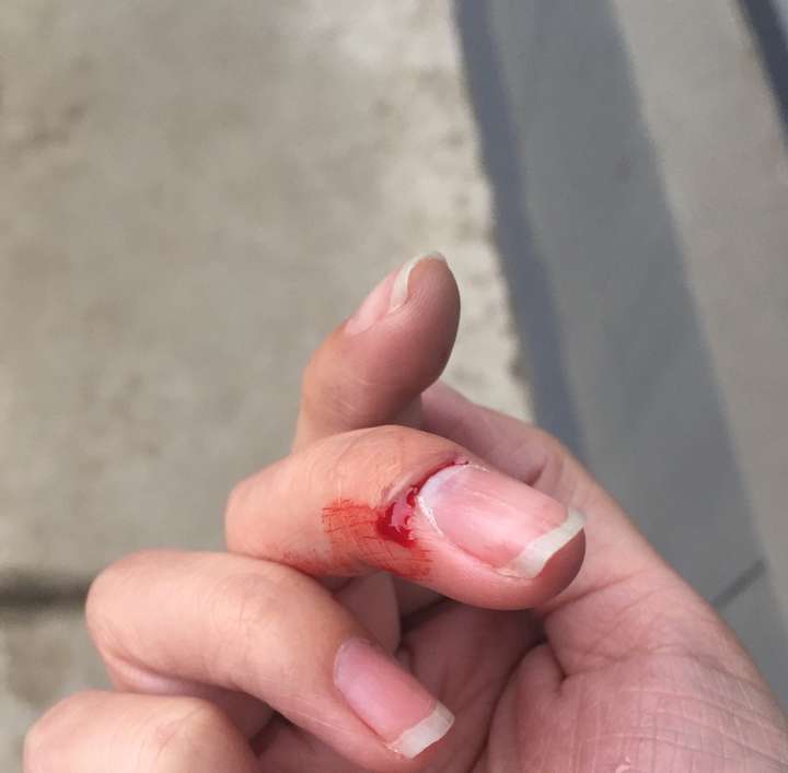 手指被门夹到飙泪是种怎样的体验?