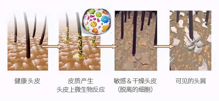 润氧秀头皮微生态环境的护花使者