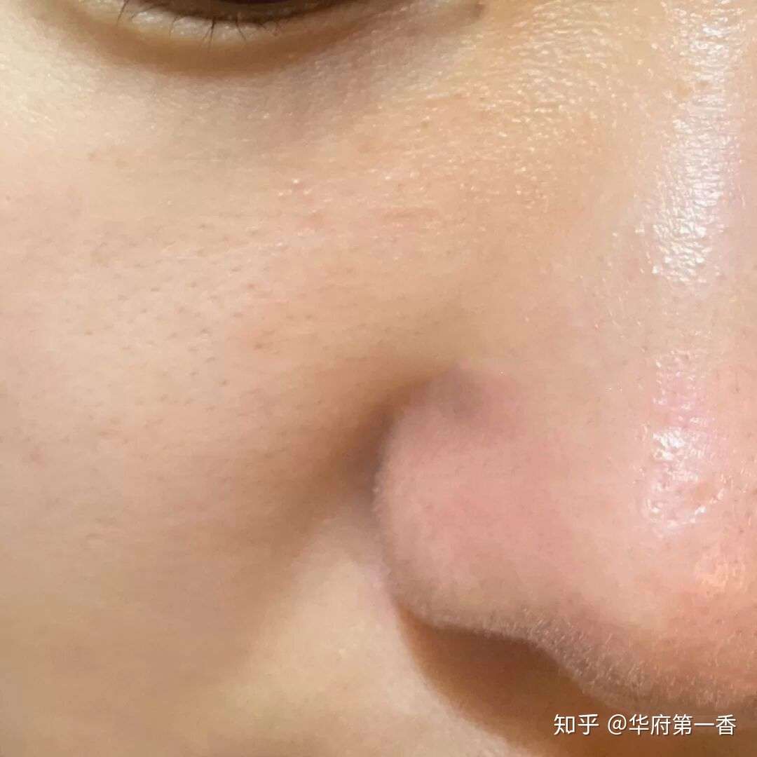 怎么把自己皮肤养的好好的 知乎
