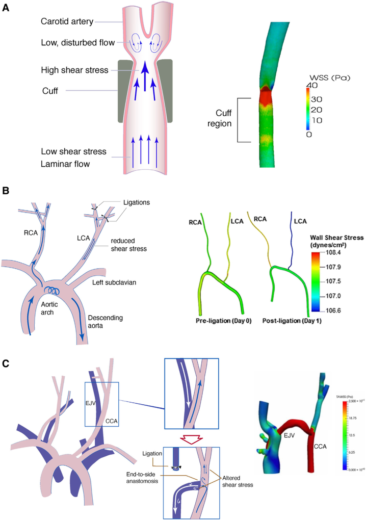 動(dòng)脈粥樣硬化中的內(nèi)皮細(xì)胞力學(xué)生物學(xué)