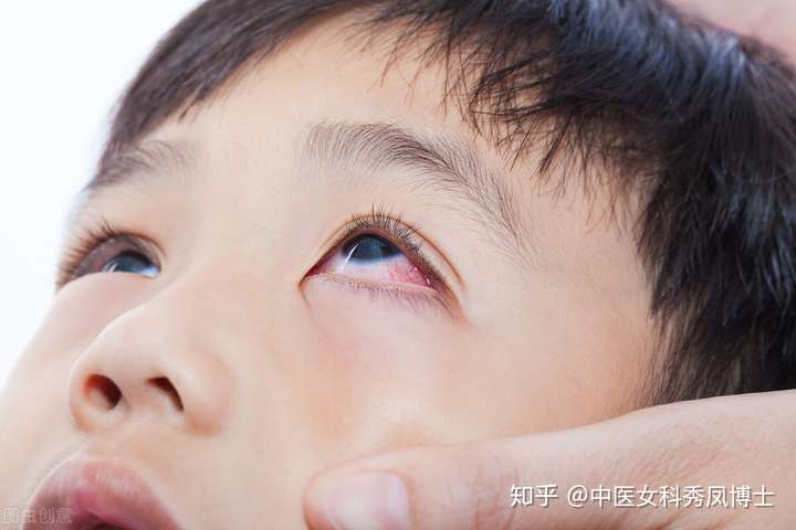 眼睛总是痒是什么原因造成的?