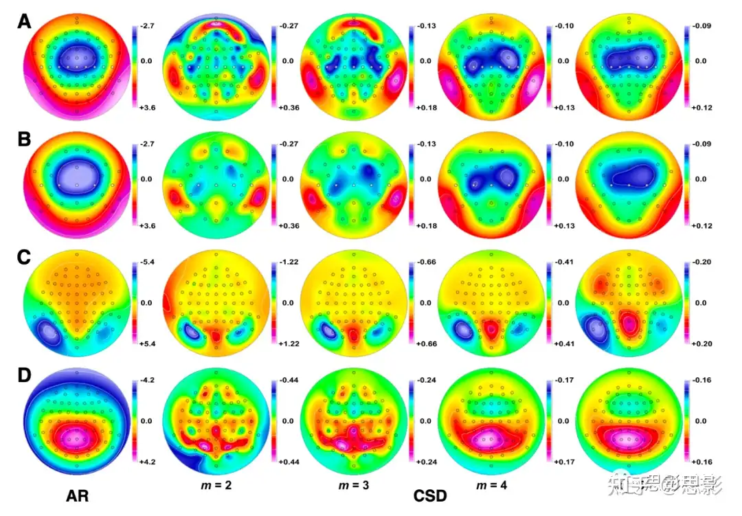 Eeg Erp研究中使用头皮表面拉普拉斯算法的问题和考虑 知乎