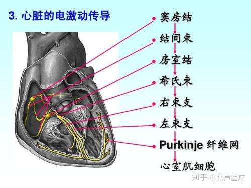 博声医疗 完全性右束支传导阻滞 知乎