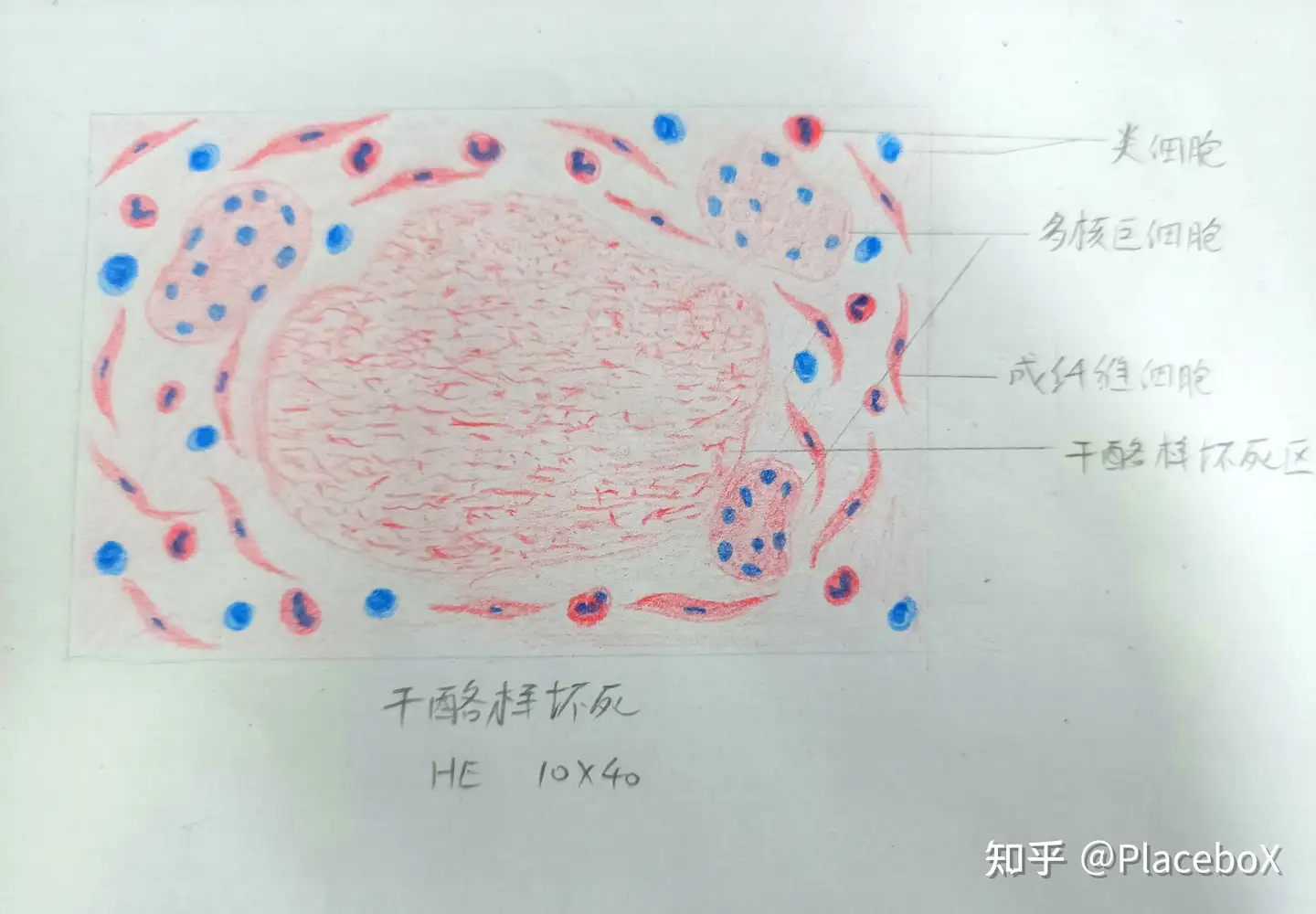 病理学实验红蓝铅笔绘图】细胞的适应，损伤与修复- 知乎