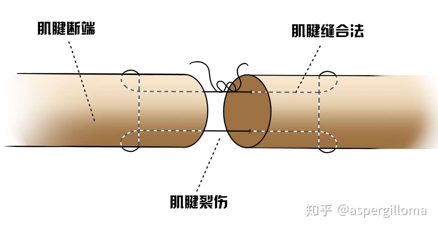 你真的了解肌腱吗 知乎