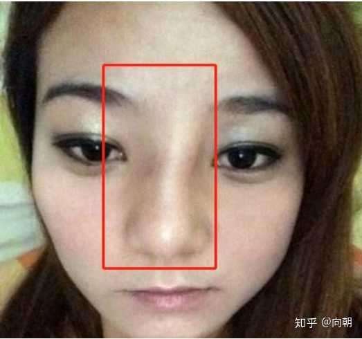 硅胶隆鼻会有后遗症吗?