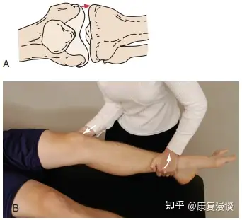 外翻/应力外翻试验是评价膝关节内侧不稳定的方法,也就是检查胫骨在