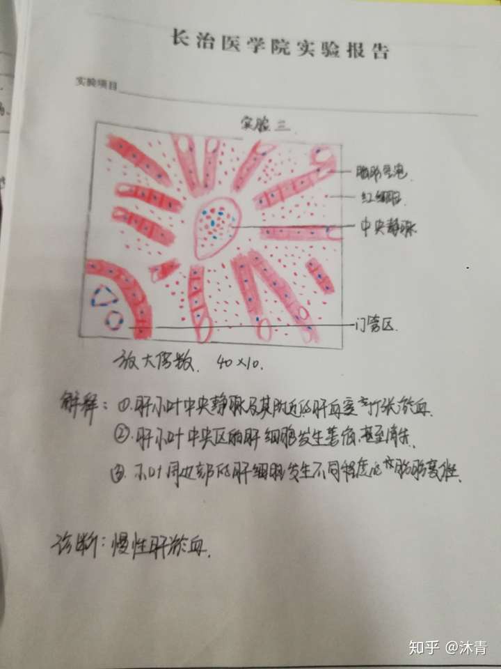 请问大家谁能教我画画肺淤血的病理实验报告图我参考一下在这谢过了