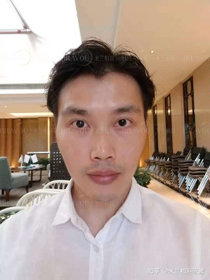 他的鼻子的鼻背侧面其实还是有高度的,不过就是正面不显,山根较低