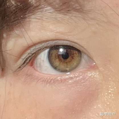 拥有和其他人不同颜色的瞳孔是什么样的体验