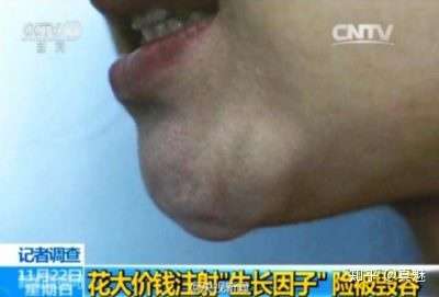 大热神器egf护肤品 其实是换着马甲偷偷卖 而且还毁容 知乎