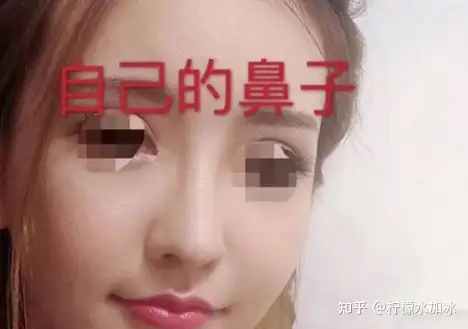 北京八大处隆鼻怎么样？好不好预约？丨八大处隆鼻最好的医生是哪个