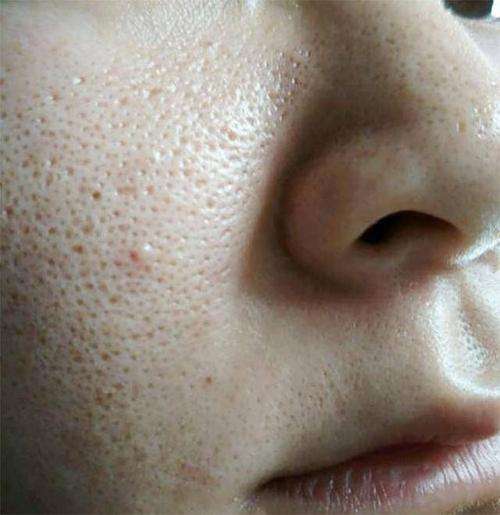 有没有人像我一样开始化妆之后毛孔变得粗大,皮肤黯淡无光,姐妹都是