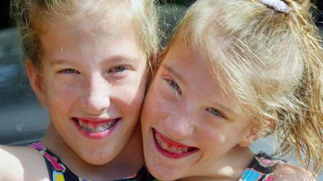 Abby and Brittany Hensel: Conjoined Twins Tour London! Sightseeing