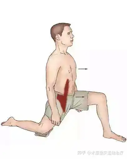 走路呈现伸髋不足屈髋过度如何解决