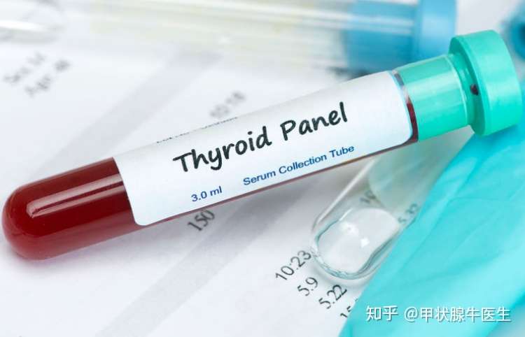 甲状腺功能报告 7个指标 一表读懂 知乎