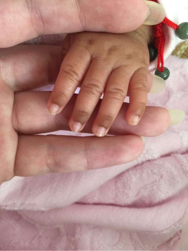 婴儿十个手指前端发黑图片