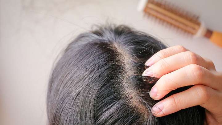探寻脱发的秘密：揭秘最新治疗趋势与方法