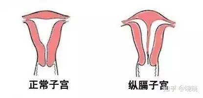 锯见嚣筐报恢形肤绿阐鹤亡(图4)