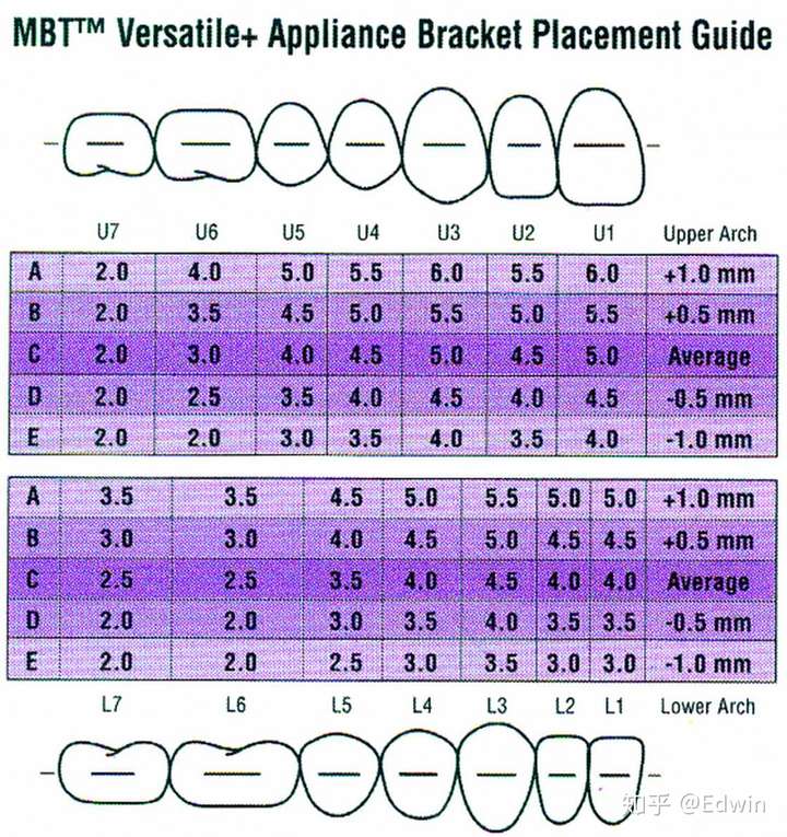 不同的医生黏正畸托槽时会有不同的选择吗