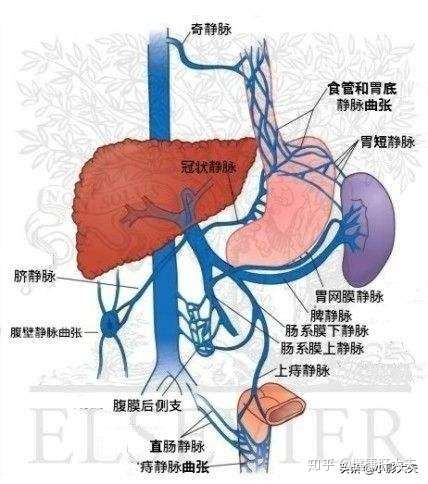 门静脉高压会引起多少疾病 知乎