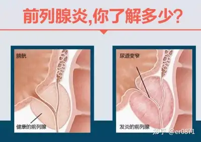 秒予仓至资尊榜？(图2)