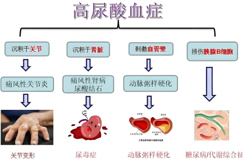 科研级降尿酸方案，美国pdnaxi尿酸宝进驻中国，引领国内健康新风尚