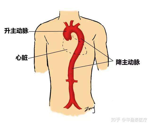 心健康主動脈夾層是什麼病有多危險