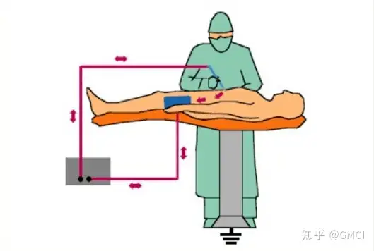 德國(guó)GMC醫(yī)療質(zhì)控提供高頻電刀測(cè)試方法插圖1