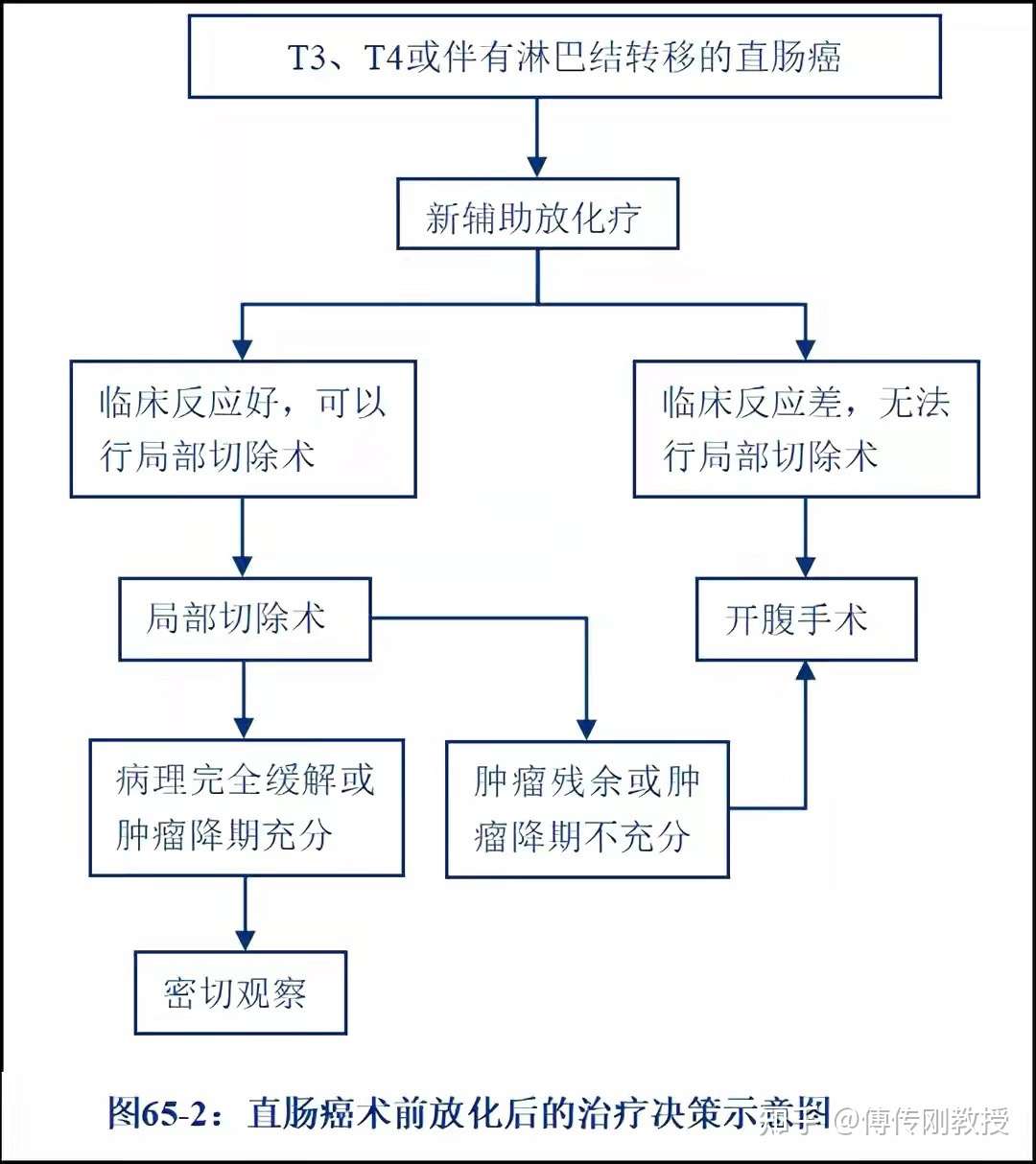 术前放疗结束后多长时间才能行手术治疗 知乎