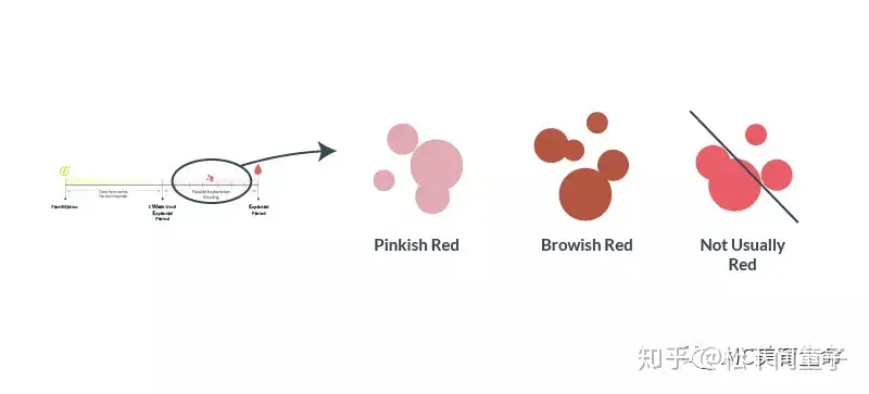 如何区分是 大姨妈 来了还是着床成功了 知乎