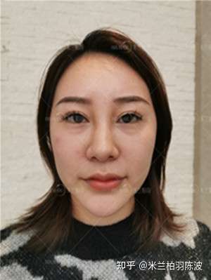 我的鼻子是不是很大?