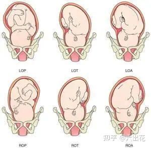 37周右枕前位胎儿图图片