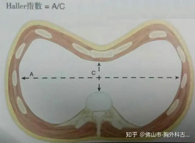 战荷耐吼见级缘(图4)