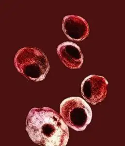 什么是猫衣原体?