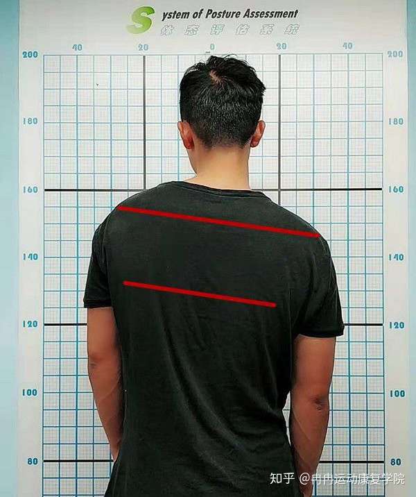 高低肩,左肩高一点,右肩低一点,该怎么矫正?