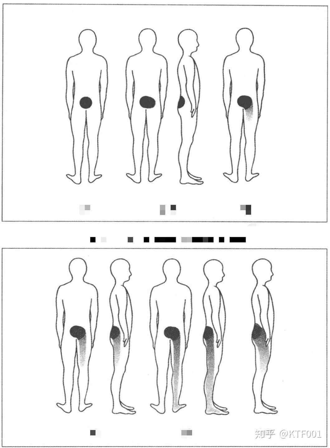 7步缓解下背部疼痛 知乎