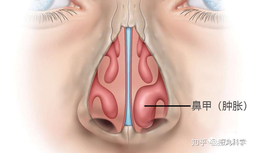 感冒时为什么鼻子只有一边通气 因为两个鼻孔总有一个在偷懒 知乎