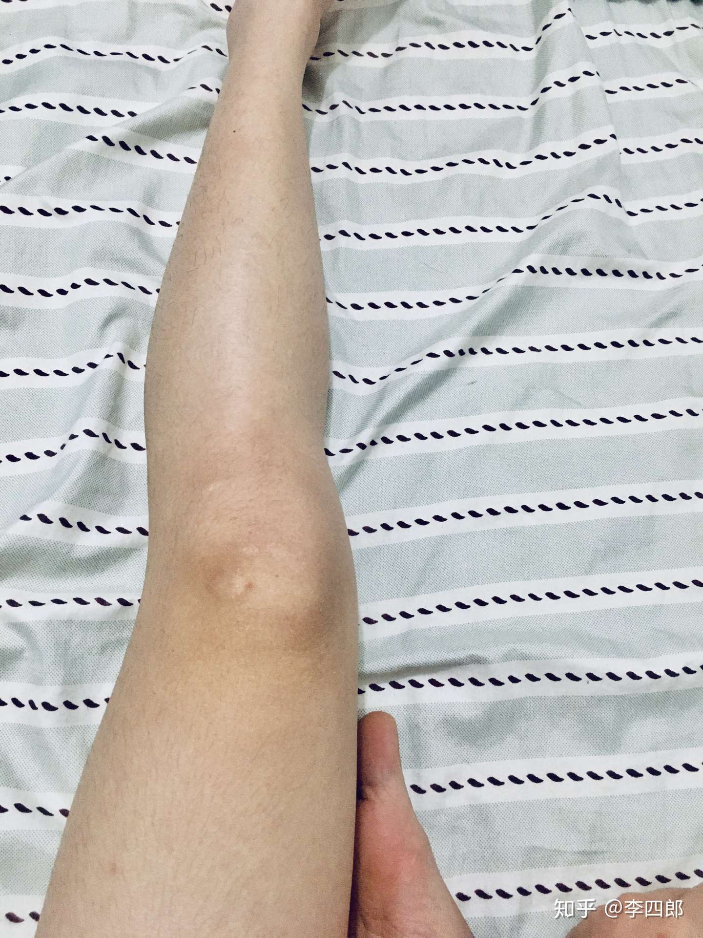 为什么要刮腿毛和腋毛 知乎