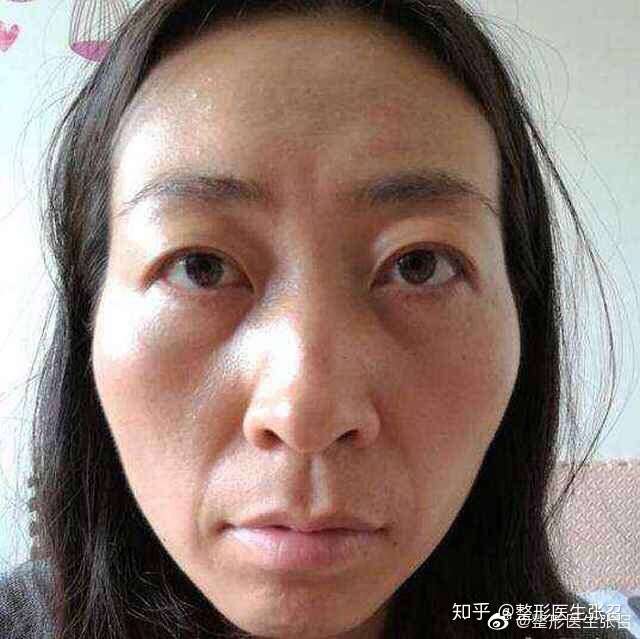 颧骨是什么地方能发图片指出来给我看看还有颧骨高什么意思?