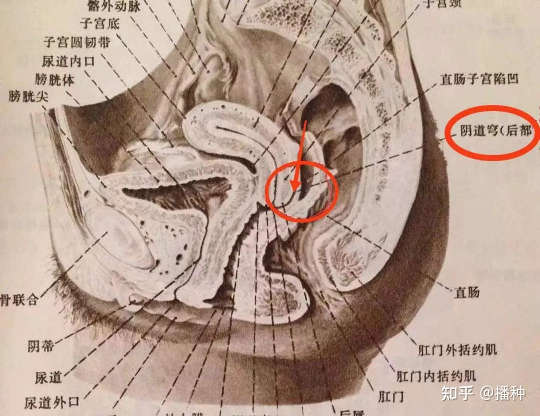 一种异常的子宫位置 子宫后位是否会造成不孕 知乎