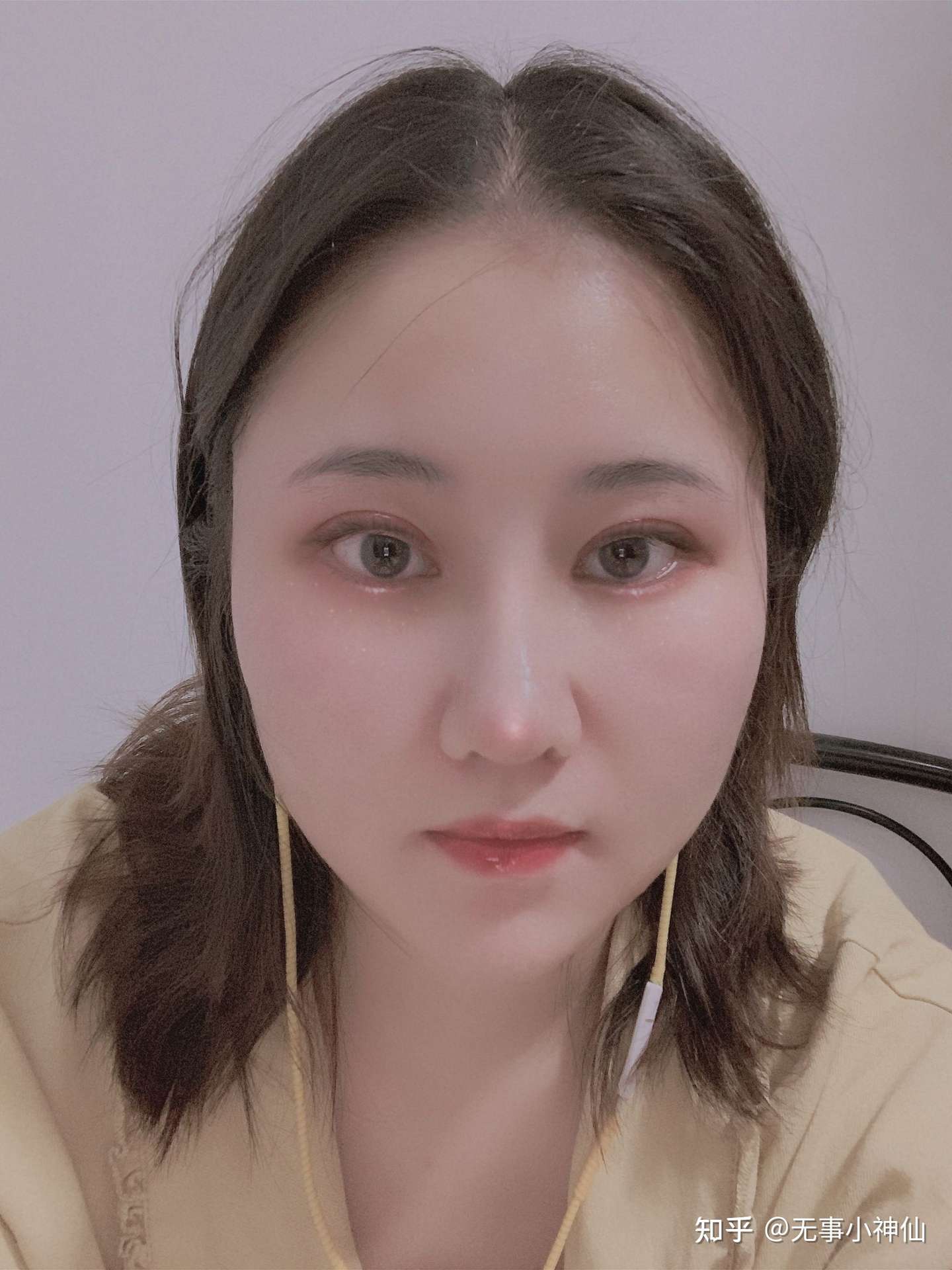 整形成功是种什么样的体验 知乎